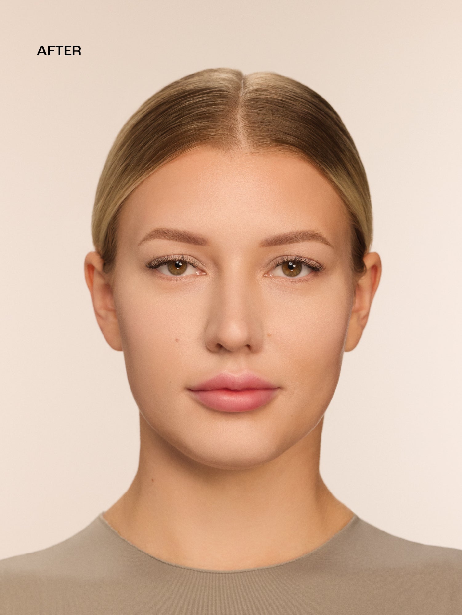 10 - Light Undertone